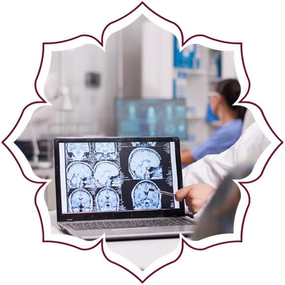 Brain Injury Rehab Case Study 